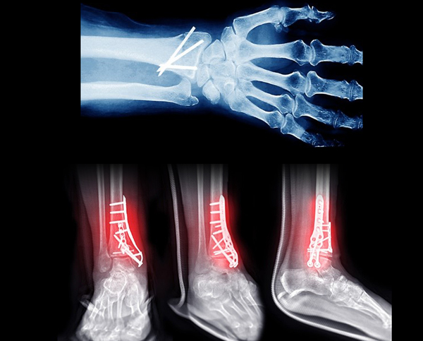 ���� ����