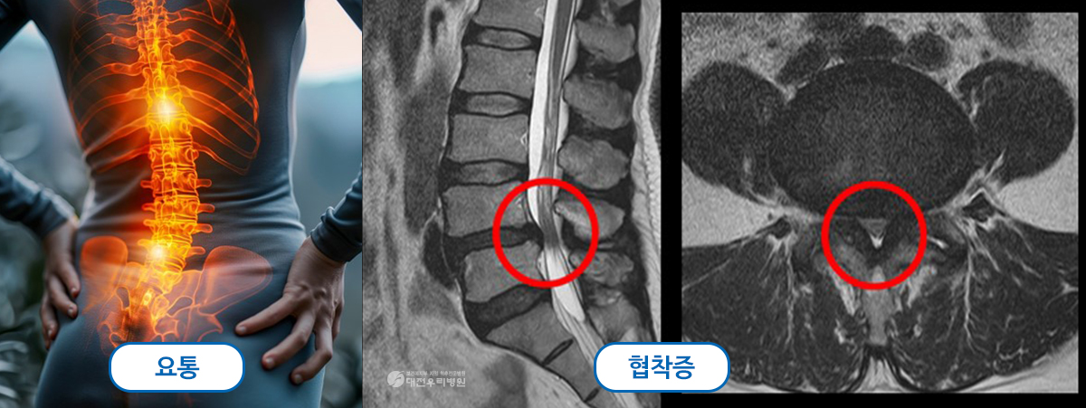 ô�� ���� �� ��Ȱġ��