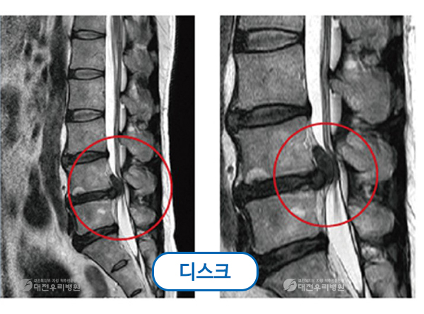 ô�� ���� �� ��Ȱġ��